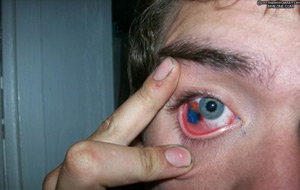 Espectaculares tatuajes en el globo ocular