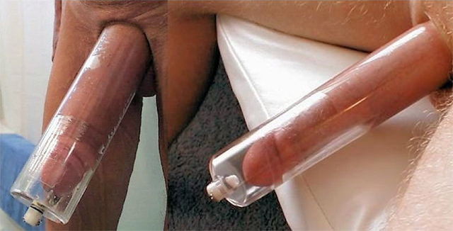 Si es posible aumentar el miembro la opinión de los médicos