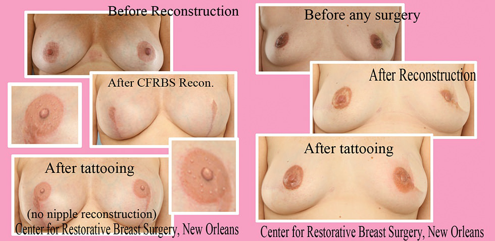 pezones tatuados