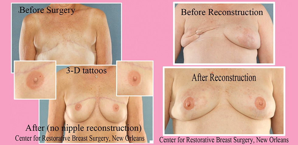 pezones tatuados