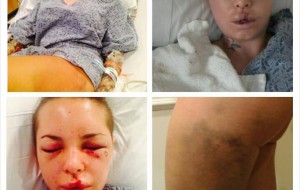 Christy Mack relata la paliza de War Machine