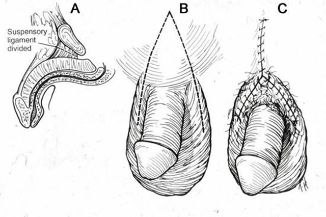 alargapene-18.jpg