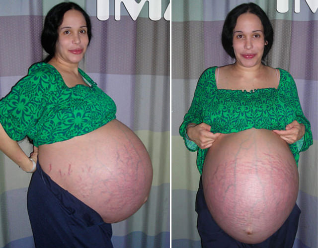 nadya-octomom-01